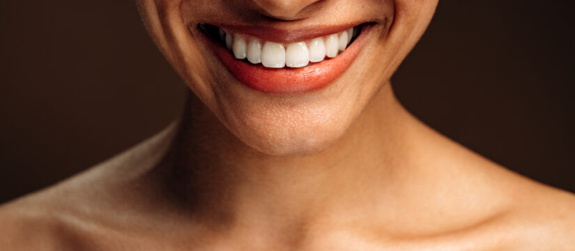 Come migliorare l’estetica dentale