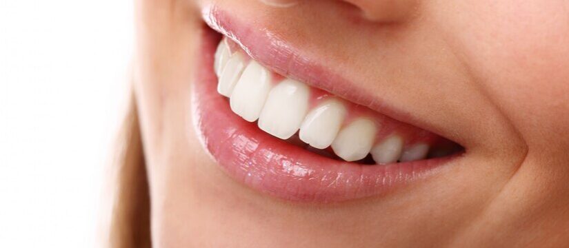 Come avere i denti bianchi: consigli e rimedi