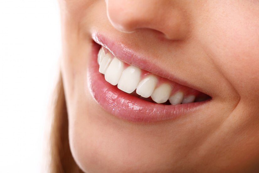 Come avere i denti bianchi: consigli e rimedi