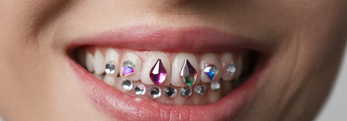 Tooth gems: cosa sono e come si applicano